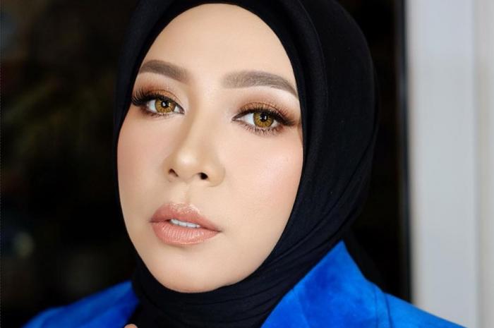 Melly Goeslaw Berhasil Menurunkan Berat Badan Usai Memotong Lambungnya Hingga Berbentuk Seperti Sebuah Pisang